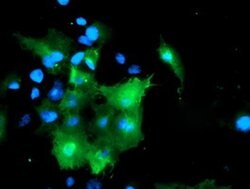 DOK7 Monoclonal Antibody (OTI1F7), TrueMAB , OriGene 100 μL; Unconjugated:Antibodies,