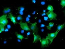DOK7 Monoclonal Antibody (OTI5G8), TrueMAB , OriGene 100 &mu;L; Unconjugated:Antibodies,