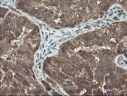 DOK7 Monoclonal Antibody (OTI1F7), TrueMAB , OriGene 100 μL; Unconjugated:Antibodies,