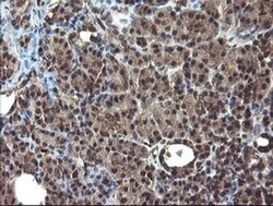 DOK7 Monoclonal Antibody (OTI1F7), TrueMAB , OriGene 100 μL; Unconjugated:Antibodies,
