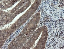 DOK7 Monoclonal Antibody (OTI1F7), TrueMAB , OriGene 100 μL; Unconjugated:Antibodies,