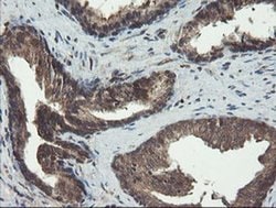 DOK7 Monoclonal Antibody (OTI1F7), TrueMAB , OriGene 100 μL; Unconjugated:Antibodies,