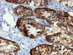 DOK7 Monoclonal Antibody (OTI5G8), TrueMAB , OriGene 100 &mu;L; Unconjugated:Antibodies,