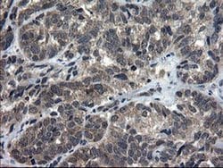 DOK7 Monoclonal Antibody (OTI7E2), TrueMAB , OriGene 30 &mu;L; Unconjugated:Antibodies,