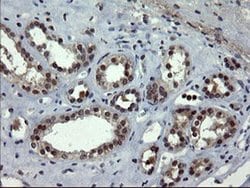 DOK7 Monoclonal Antibody (OTI7E2), TrueMAB , OriGene:Antibodies:Primary