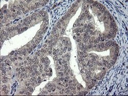 DOK7 Monoclonal Antibody (OTI7E2), TrueMAB , OriGene:Antibodies:Primary