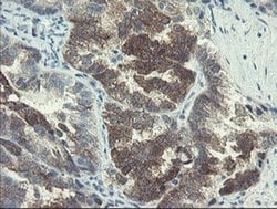 DOK7 Monoclonal Antibody (OTI1D11), TrueMAB , OriGene 30 &mu;L; Unconjugated:Antibodies,