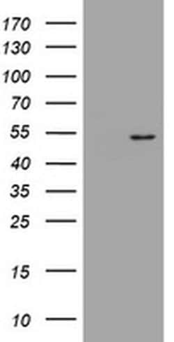 DOK7 Monoclonal Antibody (OTI2C12), TrueMAB , OriGene 30 &mu;L; Unconjugated:Antibodies,