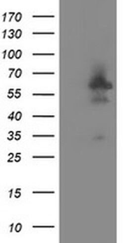 DOK7 Monoclonal Antibody (OTI1F7), TrueMAB , OriGene 100 μL; Unconjugated:Antibodies,