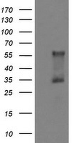 DOK7 Monoclonal Antibody (OTI5G8), TrueMAB , OriGene 100 &mu;L; Unconjugated:Antibodies,