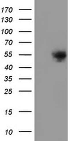 DOK7 Monoclonal Antibody (OTI7E2), TrueMAB , OriGene 30 &mu;L; Unconjugated:Antibodies,
