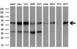 DOK7 Monoclonal Antibody (OTI7E2), TrueMAB , OriGene 30 &mu;L; Unconjugated:Antibodies,