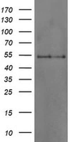 DOK7 Monoclonal Antibody (OTI1D11), TrueMAB , OriGene 30 &mu;L; Unconjugated:Antibodies,