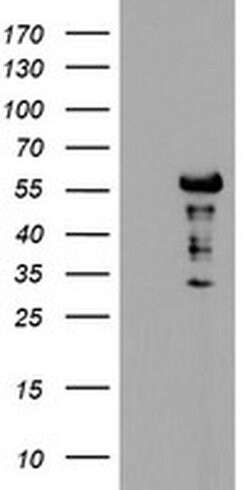 DOK7 Monoclonal Antibody (OTI3C12), TrueMAB , OriGene:Antibodies:Primary