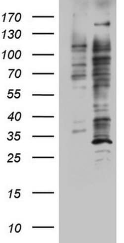 DOT1L Monoclonal Antibody (OTI1F6), TrueMAB , OriGene:Antibodies:Primary