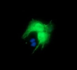 DPCD Mouse anti-Human, Clone: OTI4B9, lyophilized, TrueMAB 100 &mu;g; Unconjugated:Antibodies,