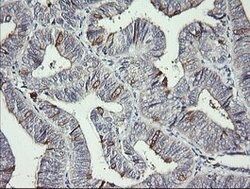 DPCD Mouse anti-Human, Clone: OTI4B9, lyophilized, TrueMAB 100 &mu;g; Unconjugated:Antibodies,