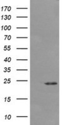 DPCD Mouse anti-Human, Clone: OTI4B9, lyophilized, TrueMAB 100 &mu;g; Unconjugated:Antibodies,