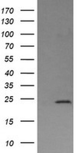 DPCD Monoclonal Antibody (OTI8A12), TrueMAB , OriGene 100 &mu;L; Unconjugated:Antibodies,