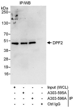 DPF2 Rabbit anti-Human, Polyclonal, Bethyl Laboratories 100 &mu;L; Unconjugated:Antibodies,