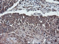 DPH2 Monoclonal Antibody (OTI4E7), TrueMAB , OriGene 30 &mu;L; Unconjugated:Antibodies,