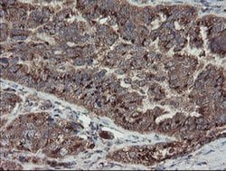 DPH2 Monoclonal Antibody (OTI4E7), TrueMAB , OriGene:Antibodies:Primary