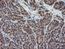 DPH2 Monoclonal Antibody (OTI4E7), TrueMAB , OriGene 30 &mu;L; Unconjugated:Antibodies,