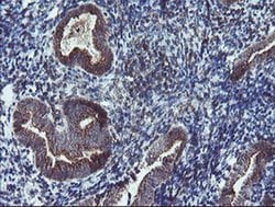 DPH2 Monoclonal Antibody (OTI4E7), TrueMAB , OriGene 30 &mu;L; Unconjugated:Antibodies,