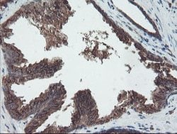 DPH2 Monoclonal Antibody (OTI4E7), TrueMAB , OriGene 30 &mu;L; Unconjugated:Antibodies,