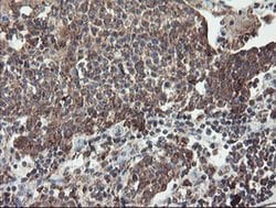DPH2 Monoclonal Antibody (OTI4E7), TrueMAB , OriGene 30 &mu;L; Unconjugated:Antibodies,