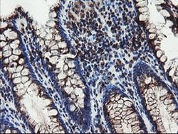DPH2 Monoclonal Antibody (OTI4E7), TrueMAB , OriGene 30 &mu;L; Unconjugated:Antibodies,