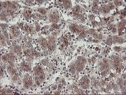 DPH2 Monoclonal Antibody (OTI4E7), TrueMAB , OriGene 30 &mu;L; Unconjugated:Antibodies,