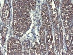 DPH2 Mouse anti-Human, Clone: OTI3A12, lyophilized, TrueMAB 100 &mu;g;