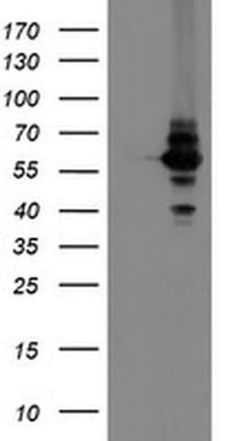 DPH2 Monoclonal Antibody (OTI4E7), TrueMAB , OriGene 30 &mu;L; Unconjugated:Antibodies,
