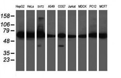 DPH2 Monoclonal Antibody (OTI4E7), TrueMAB , OriGene 30 &mu;L; Unconjugated:Antibodies,