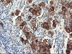 DPP10 Mouse anti-Human, Clone: OTI1A5, lyophilized, TrueMAB 100 &mu;g;