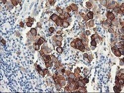 DPP10 Monoclonal Antibody (OTI1A5), TrueMAB , OriGene 100 &mu;L; Unconjugated:Antibodies,