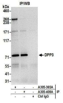DPP3 Rabbit anti-Human, Polyclonal, Bethyl Laboratories 10 &mu;L; Unconjugated:Antibodies,