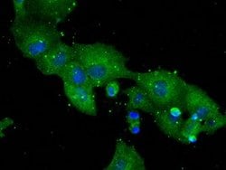 DPP4 Mouse anti-Human, Clone: OTI11D7, lyophilized, TrueMAB 100 &mu;g;