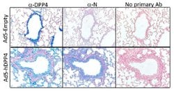 DPP4 Mouse anti-Human, Clone: OTI11D7, lyophilized, TrueMAB 100 &mu;g;
