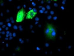 DPP9 Monoclonal Antibody (OTI2F10), TrueMAB , OriGene 100 &mu;L; Unconjugated:Antibodies,