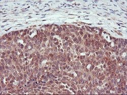 DPP9 Monoclonal Antibody (OTI6A12), TrueMAB , OriGene 100 &mu;L; Unconjugated:Antibodies,