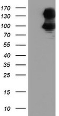 DPP9 Monoclonal Antibody (OTI2F10), TrueMAB , OriGene 100 &mu;L; Unconjugated:Antibodies,