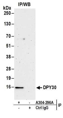 DPY30 Rabbit anti-Human, Polyclonal, Bethyl Laboratories 10 &mu;L; Unconjugated:Antibodies,