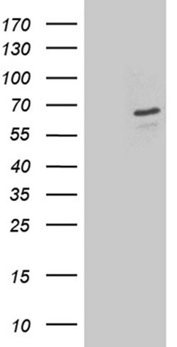 DPYSL2 Monoclonal Antibody (OTI2C9), TrueMAB , OriGene 100 &mu;L; Unconjugated:Antibodies,