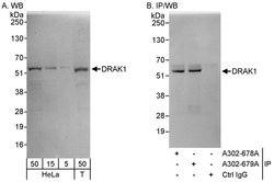 DRAK1 Rabbit anti-Human, Polyclonal, Bethyl Laboratories 100 &mu;L; Unconjugated:Antibodies,
