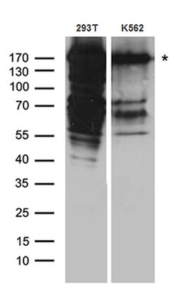 DSG1 Rabbit anti-Human, Polyclonal, liquid, OriGene 100 &mu;L; Unconjugated:Antibodies,