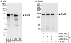 DSG2 Rabbit anti-Human, Polyclonal, Bethyl Laboratories 100 &mu;L; Unconjugated:Antibodies,