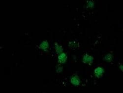 DSTN Mouse anti-Canine, Human, Clone: OTI2E10, liquid, TrueMAB 100 &mu;L;