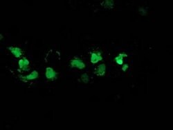 DSTN Monoclonal Antibody (OTI1C8), TrueMAB , OriGene 100 &mu;L; Unconjugated:Antibodies,